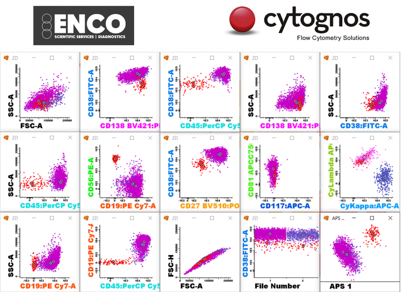 Webinar - How To Analyze A MM MRD Case With Infinicyt™ Software With ...